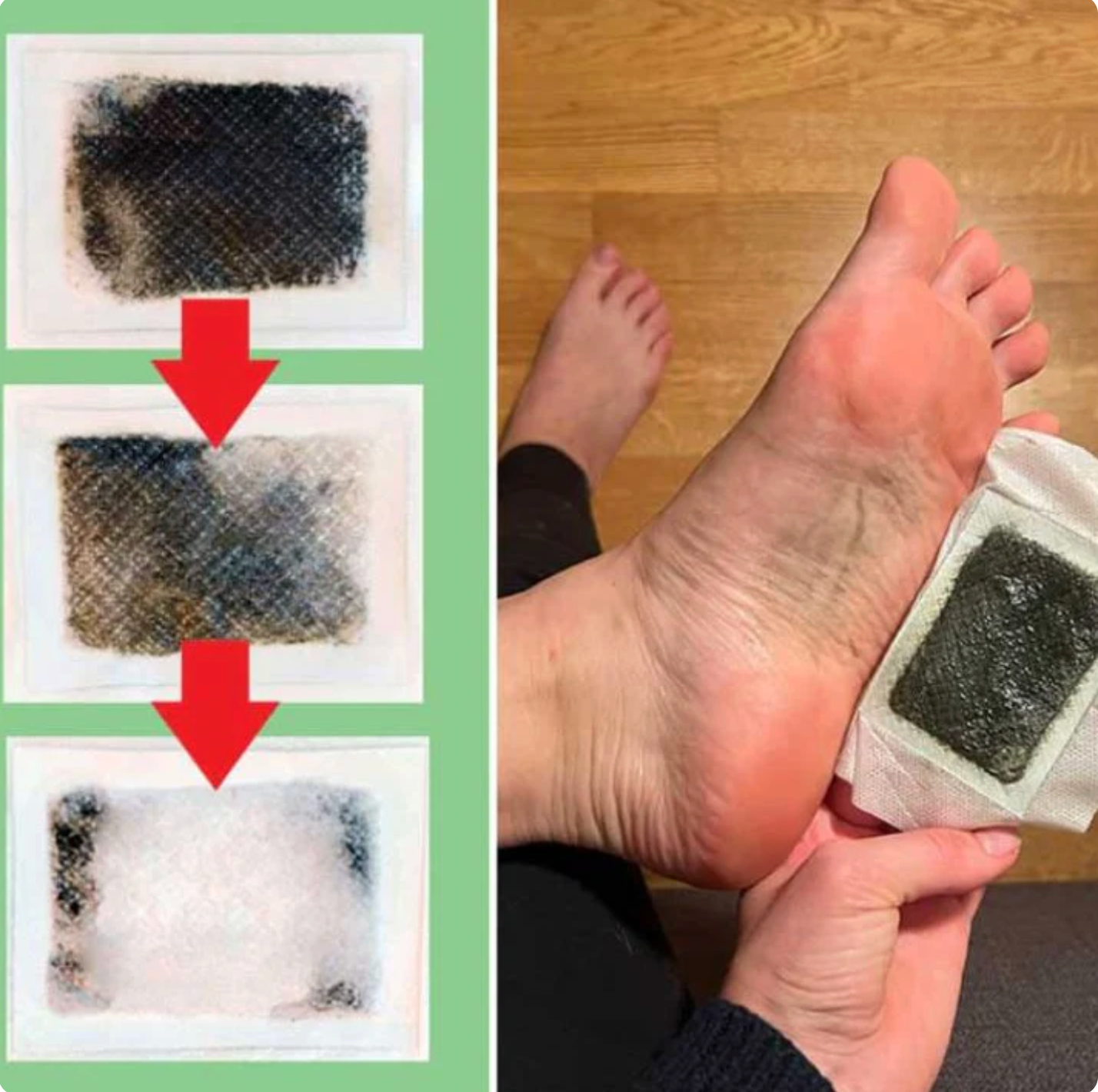 Revivor™ Detox Patches | Reduces Bloating & removes toxins